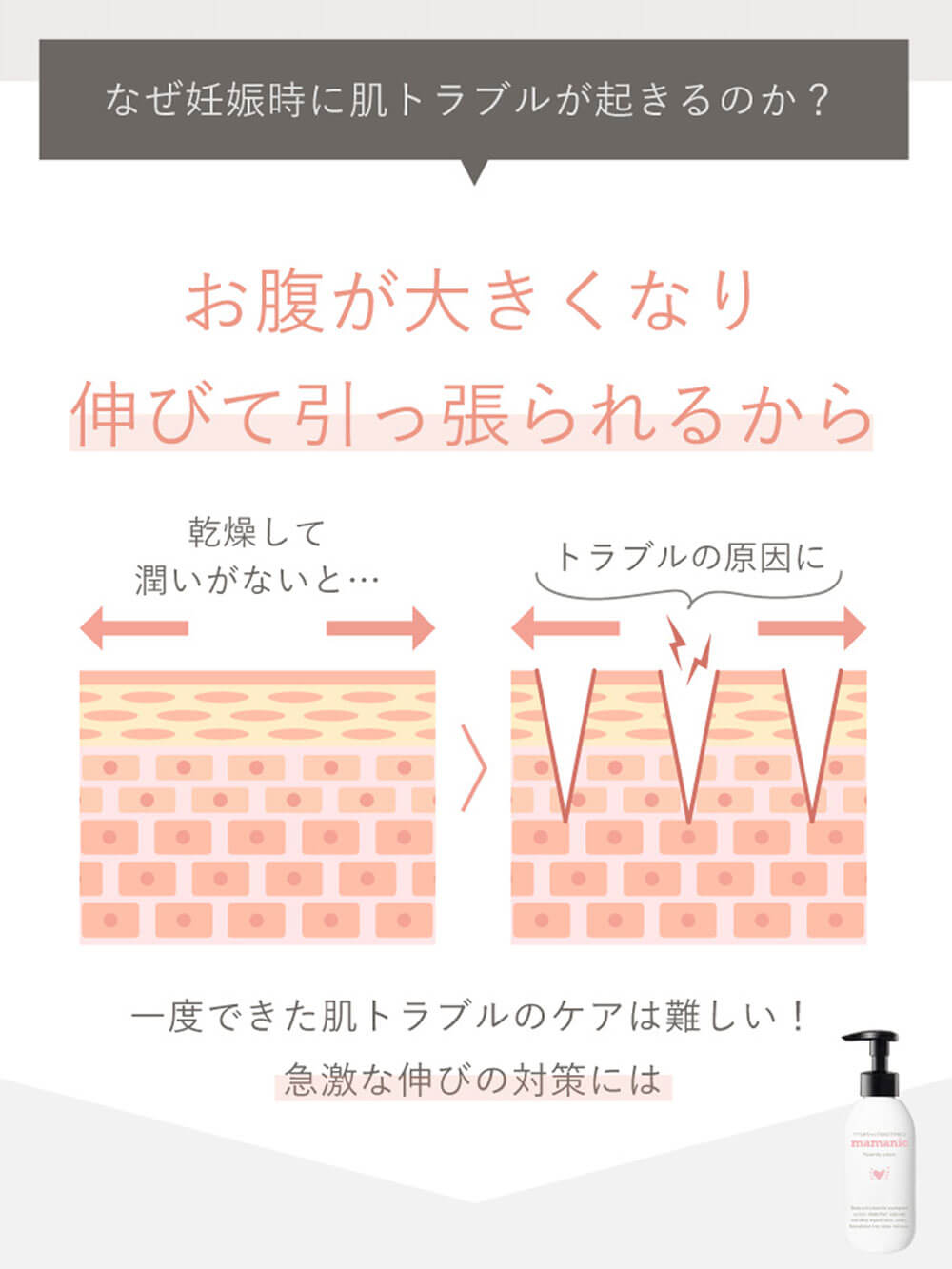 なぜ妊娠時に肌トラブルが起きるのか？